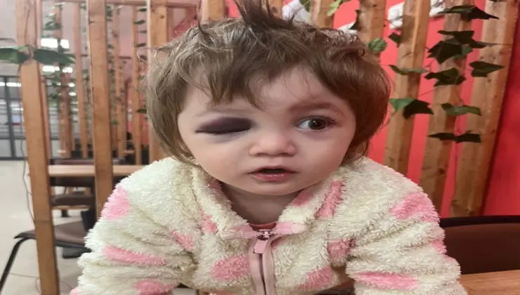 14 aylık bebeğin darbedildiği olayda şüphelilerin sözü ortaya çıktı